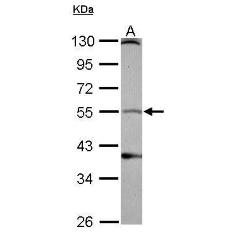 Dopamine Receptor D1 Antibody from Signalway Antibody (35341) - Antibodies.com