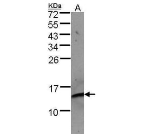 beta 2 Microglobulin Antibody from Signalway Antibody (35366) - Antibodies.com