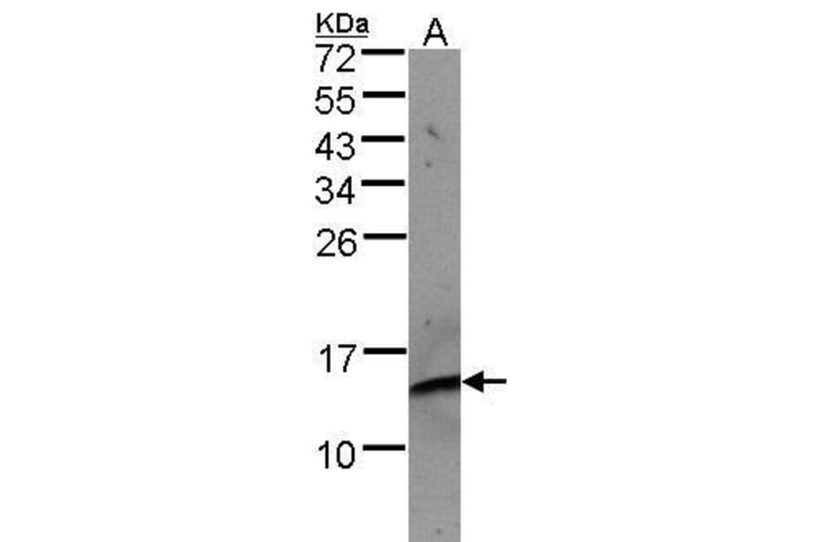 beta 2 Microglobulin Antibody from Signalway Antibody (35366) - Antibodies.com