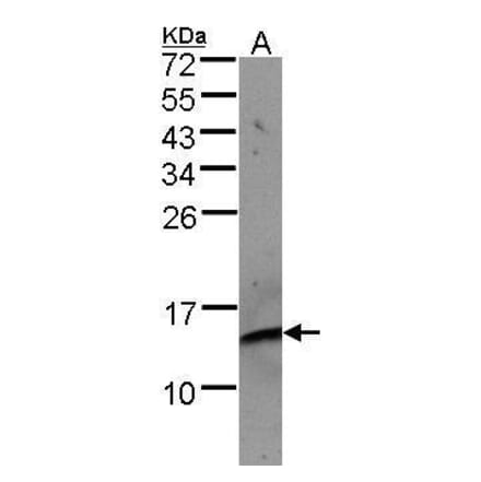 beta 2 Microglobulin Antibody from Signalway Antibody (35366) - Antibodies.com