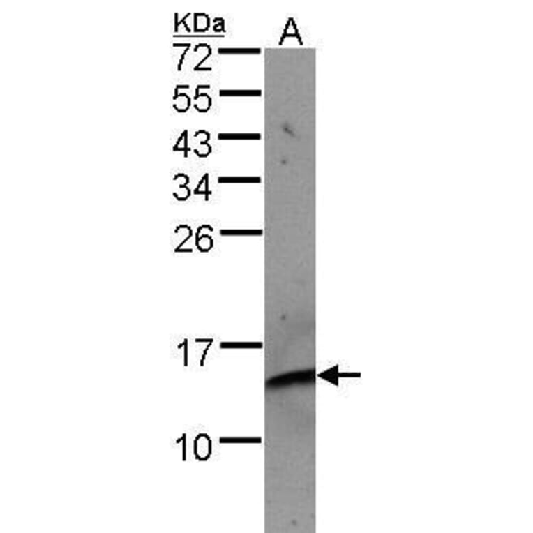 beta 2 Microglobulin Antibody from Signalway Antibody (35366) - Antibodies.com