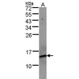 beta 2 Microglobulin Antibody from Signalway Antibody (35366) - Antibodies.com
