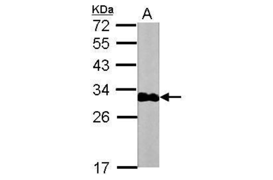 Troponin I (cardiac) Antibody from Signalway Antibody (35508) - Antibodies.com