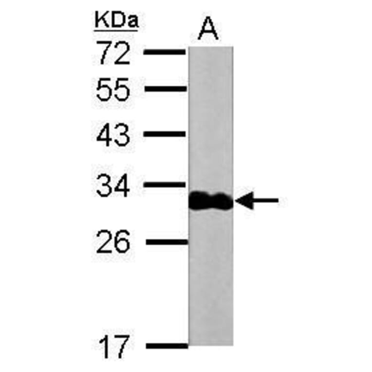 Troponin I (cardiac) Antibody from Signalway Antibody (35508) - Antibodies.com