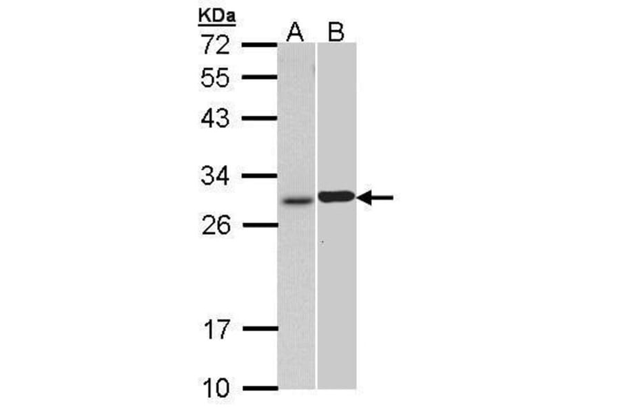 Troponin I (cardiac) Antibody from Signalway Antibody (35508) - Antibodies.com