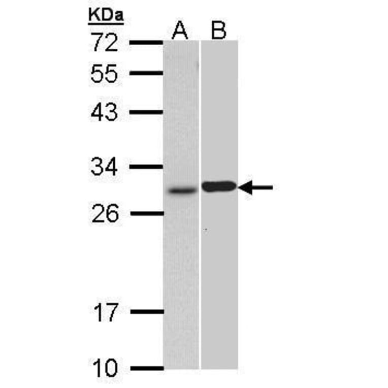 Troponin I (cardiac) Antibody from Signalway Antibody (35508) - Antibodies.com