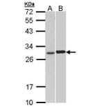 Troponin I (cardiac) Antibody from Signalway Antibody (35508) - Antibodies.com