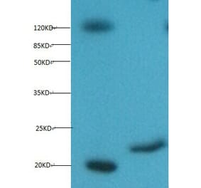 Myoglobin Monoclonal Antibody from Signalway Antibody (42039) - Antibodies.com