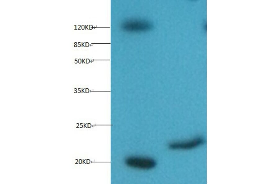 Myoglobin Monoclonal Antibody from Signalway Antibody (42039) - Antibodies.com
