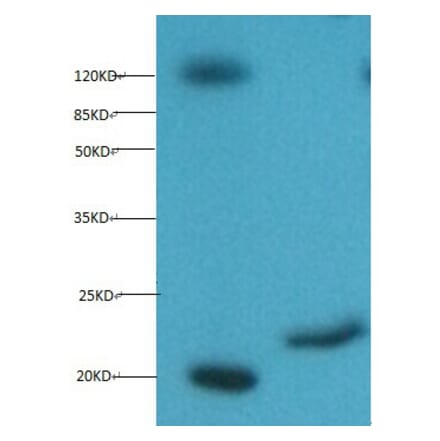 Myoglobin Monoclonal Antibody from Signalway Antibody (42039) - Antibodies.com