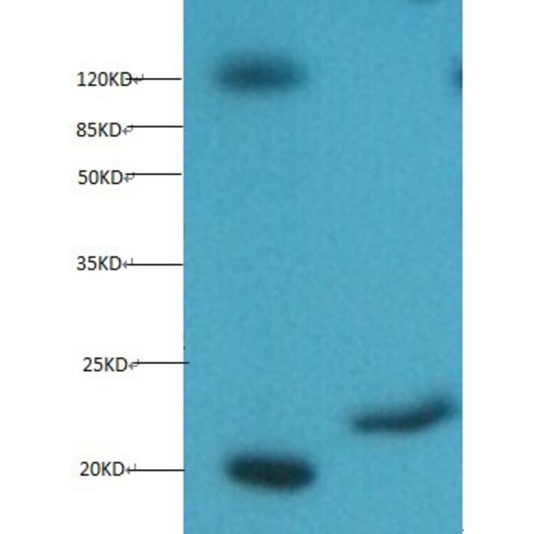 Myoglobin Monoclonal Antibody from Signalway Antibody (42039) - Antibodies.com