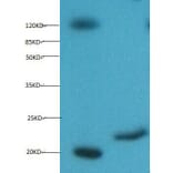 Myoglobin Monoclonal Antibody from Signalway Antibody (42039) - Antibodies.com