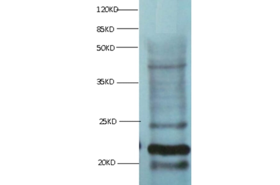Myoglobin Monoclonal Antibody from Signalway Antibody (42039) - Antibodies.com