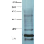 Myoglobin Monoclonal Antibody from Signalway Antibody (42039) - Antibodies.com