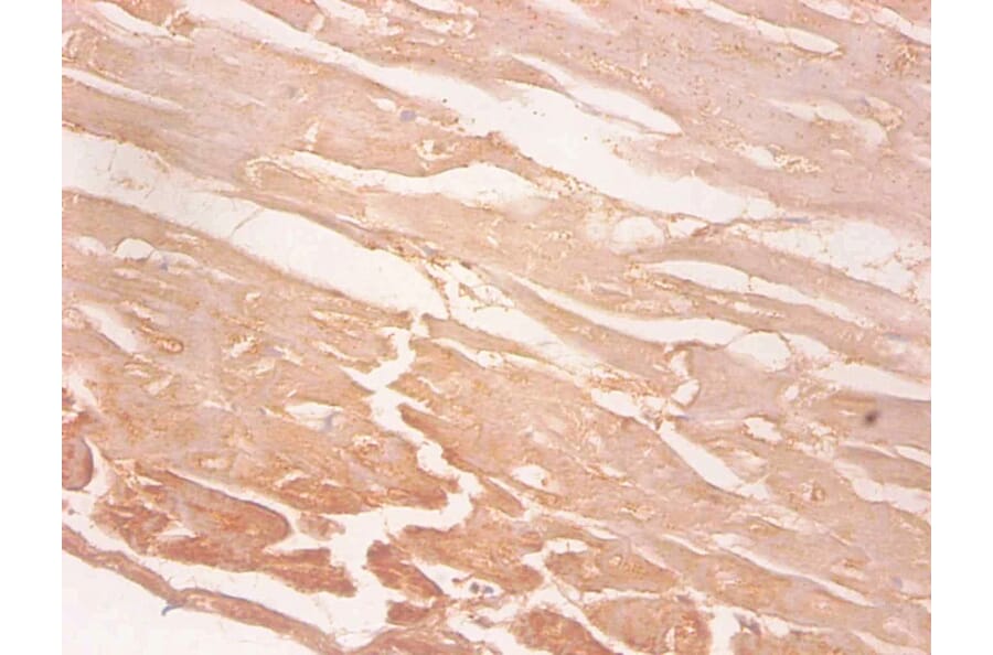 Immunohistochemistry - Myoglobin Monoclonal Antibody from Signalway Antibody (42039) - Antibodies.com
