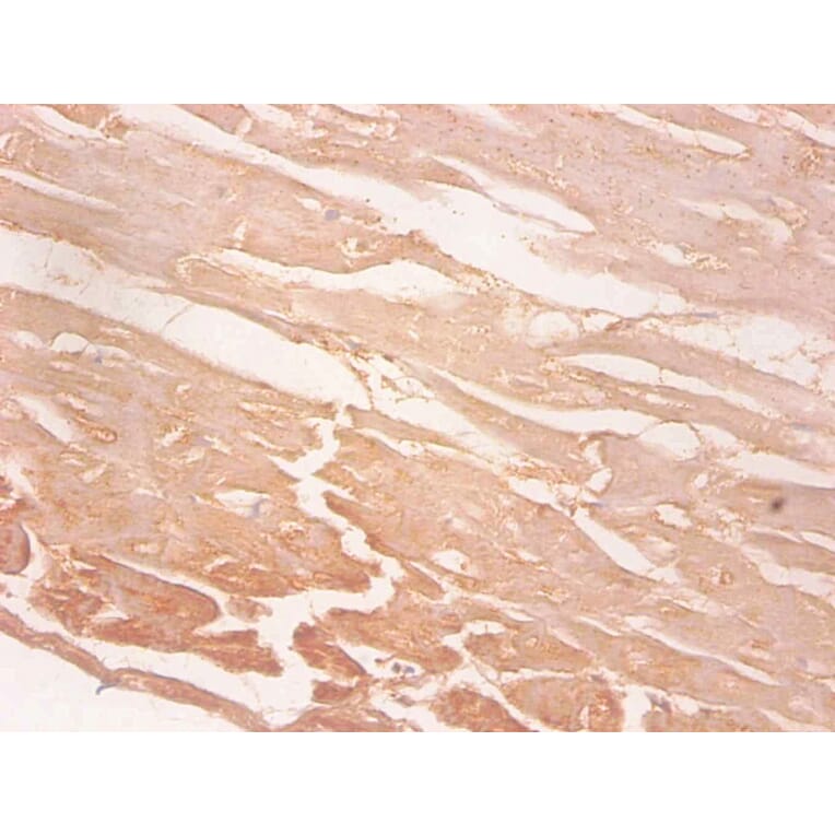 Immunohistochemistry - Myoglobin Monoclonal Antibody from Signalway Antibody (42039) - Antibodies.com