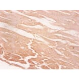 Immunohistochemistry - Myoglobin Monoclonal Antibody from Signalway Antibody (42039) - Antibodies.com