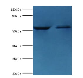 Caspase-8 Polyclonal Antibody from Signalway Antibody (42620) - Antibodies.com