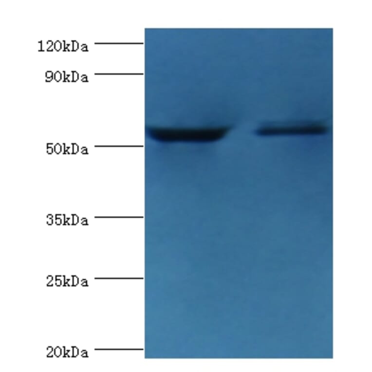 Caspase-8 Polyclonal Antibody from Signalway Antibody (42620) - Antibodies.com