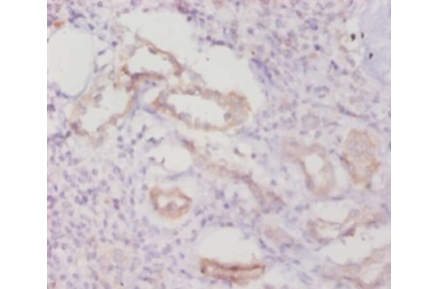 Immunohistochemistry - Caspase-8 Polyclonal Antibody from Signalway Antibody (42620) - Antibodies.com