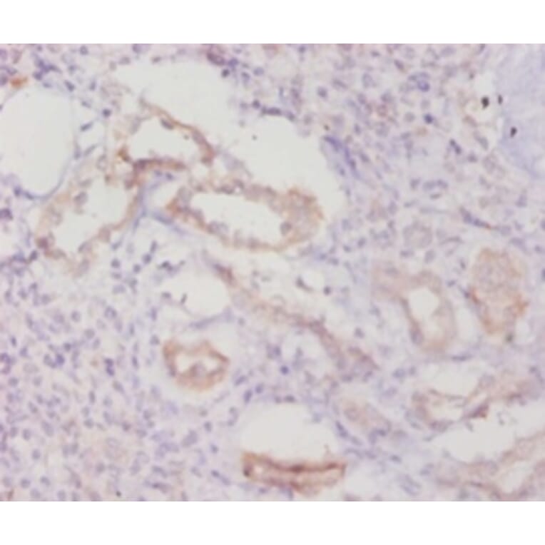 Immunohistochemistry - Caspase-8 Polyclonal Antibody from Signalway Antibody (42620) - Antibodies.com