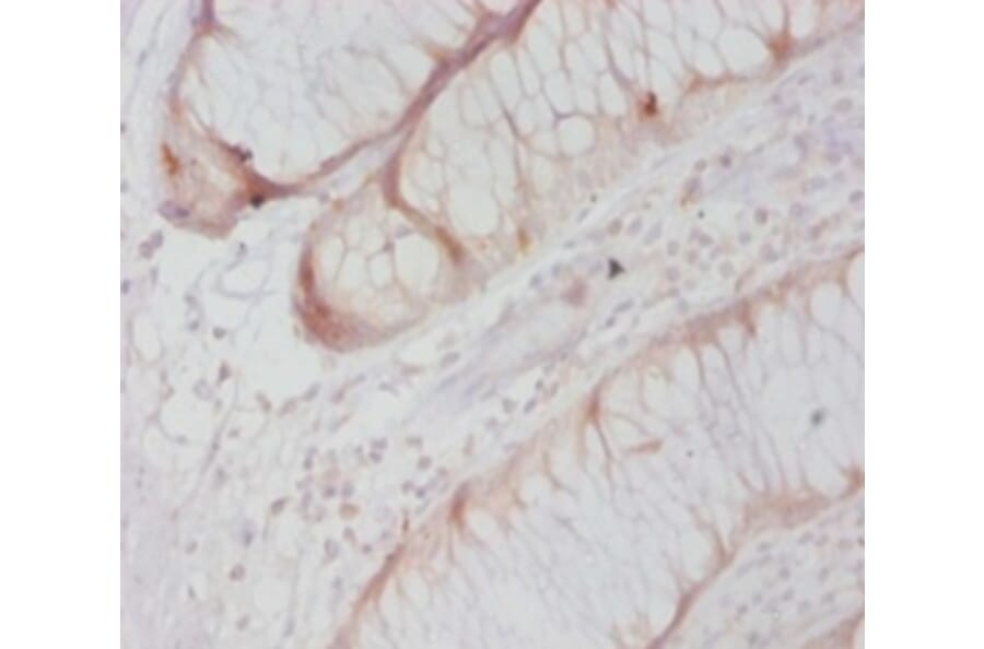 Immunohistochemistry - Caspase-8 Polyclonal Antibody from Signalway Antibody (42620) - Antibodies.com