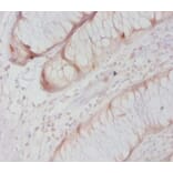 Immunohistochemistry - Caspase-8 Polyclonal Antibody from Signalway Antibody (42620) - Antibodies.com