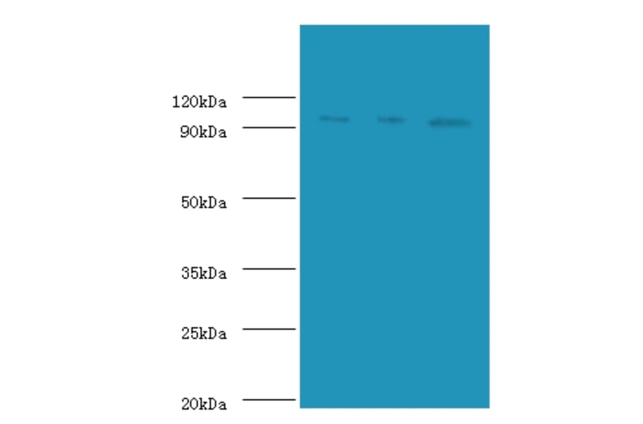 DNA replication licensing factor MCM2 Polyclonal Antibody from Signalway Antibody (42250) - Antibodies.com