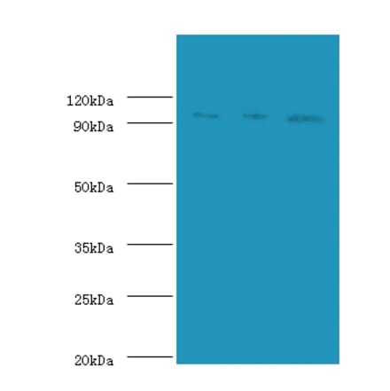 DNA replication licensing factor MCM2 Polyclonal Antibody from Signalway Antibody (42250) - Antibodies.com