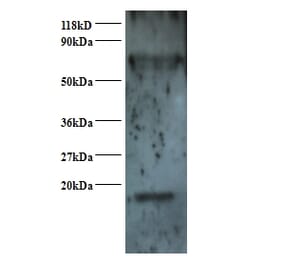 Small nuclear ribonucleoprotein Sm D2 Polyclonal Antibody from Signalway Antibody (42367) - Antibodies.com