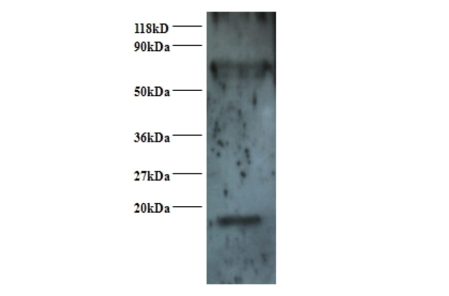 Small nuclear ribonucleoprotein Sm D2 Polyclonal Antibody from Signalway Antibody (42367) - Antibodies.com