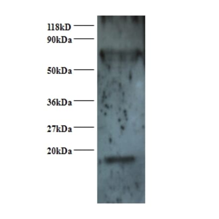 Small nuclear ribonucleoprotein Sm D2 Polyclonal Antibody from Signalway Antibody (42367) - Antibodies.com