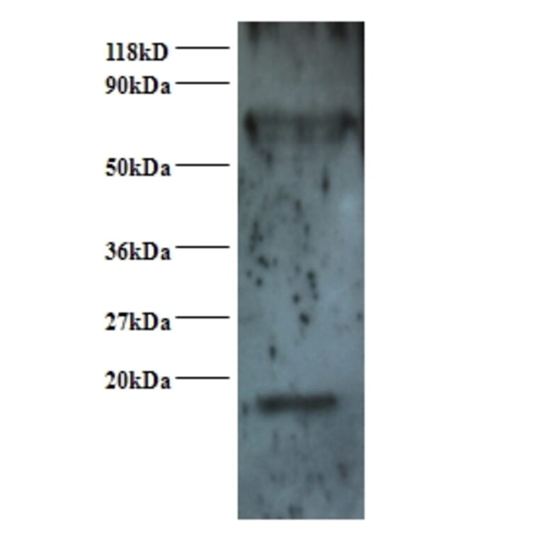 Small nuclear ribonucleoprotein Sm D2 Polyclonal Antibody from Signalway Antibody (42367) - Antibodies.com