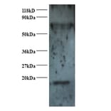 Small nuclear ribonucleoprotein Sm D2 Polyclonal Antibody from Signalway Antibody (42367) - Antibodies.com