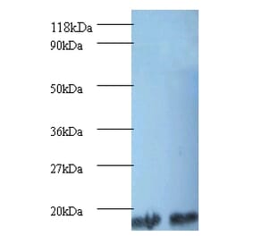 Peptidyl-prolyl cis-trans isomerase A Polyclonal Antibody from Signalway Antibody (42494) - Antibodies.com