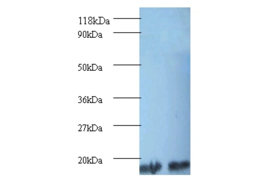 Peptidyl-prolyl cis-trans isomerase A Polyclonal Antibody from Signalway Antibody (42494) - Antibodies.com