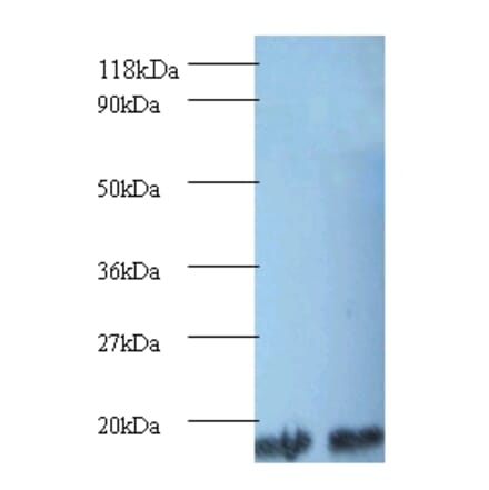 Peptidyl-prolyl cis-trans isomerase A Polyclonal Antibody from Signalway Antibody (42494) - Antibodies.com