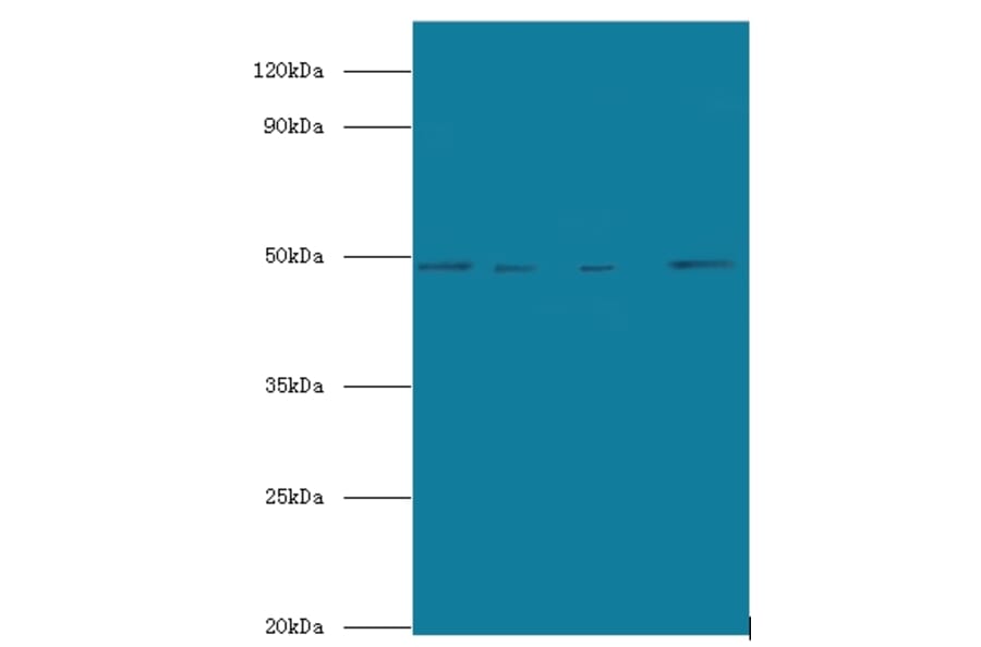 Transcriptional enhancer factor TEF-5 Polyclonal Antibody from Signalway Antibody (42673) - Antibodies.com