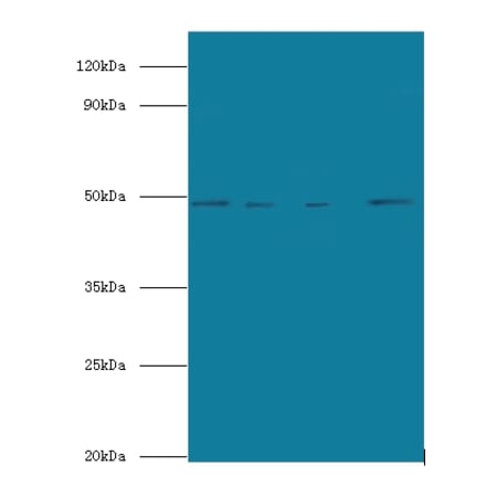 Transcriptional enhancer factor TEF-5 Polyclonal Antibody from Signalway Antibody (42673) - Antibodies.com