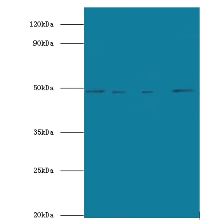 Transcriptional enhancer factor TEF-5 Polyclonal Antibody from Signalway Antibody (42673) - Antibodies.com