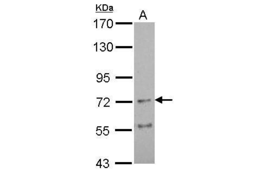 Nicotinic Acetylcholine Receptor alpha 4 Antibody from Signalway Antibody (35433) - Antibodies.com