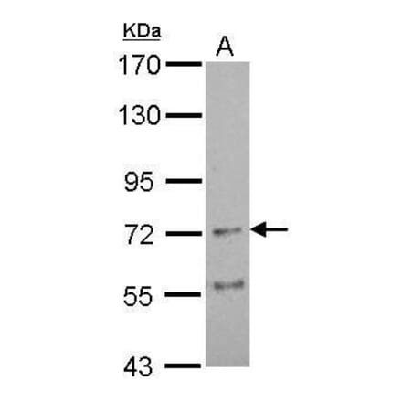 Nicotinic Acetylcholine Receptor alpha 4 Antibody from Signalway Antibody (35433) - Antibodies.com