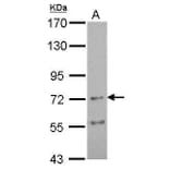 Nicotinic Acetylcholine Receptor alpha 4 Antibody from Signalway Antibody (35433) - Antibodies.com