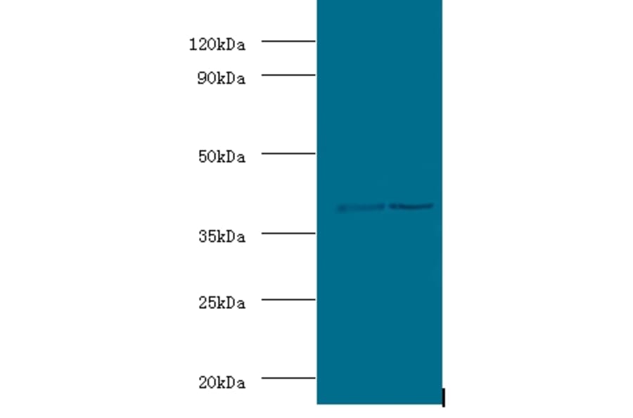 Alcohol dehydrogenase class-3 Polyclonal Antibody from Signalway Antibody (42059) - Antibodies.com