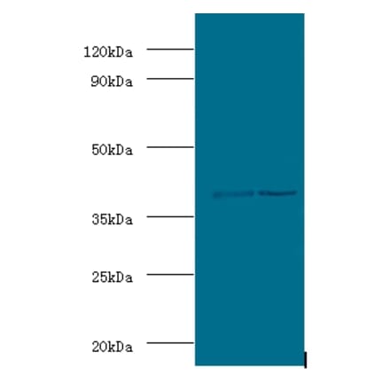 Alcohol dehydrogenase class-3 Polyclonal Antibody from Signalway Antibody (42059) - Antibodies.com
