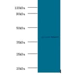 Alcohol dehydrogenase class-3 Polyclonal Antibody from Signalway Antibody (42059) - Antibodies.com