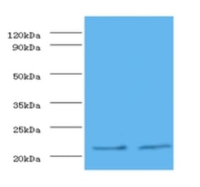 Metalloproteinase inhibitor 1 Polyclonal Antibody from Signalway Antibody (42350) - Antibodies.com
