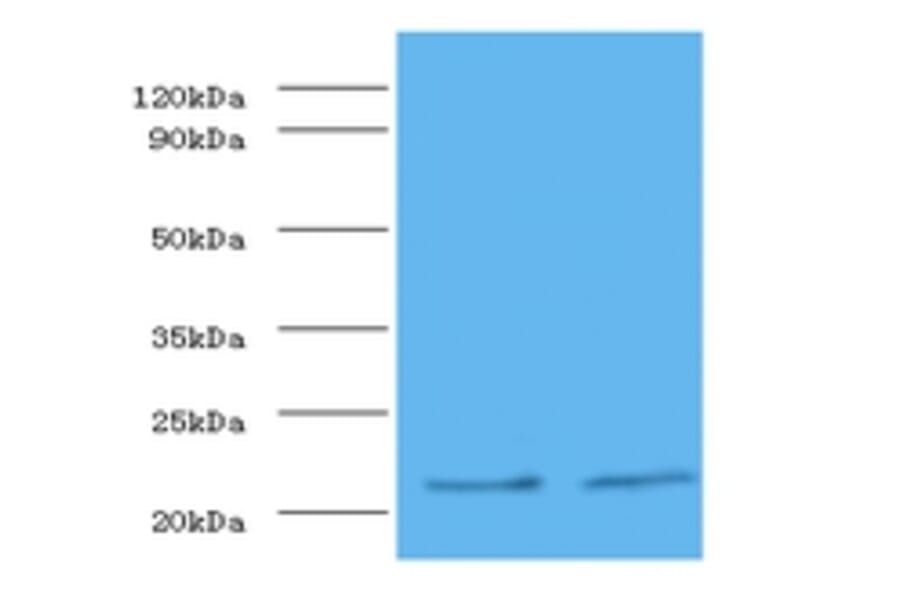 Metalloproteinase inhibitor 1 Polyclonal Antibody from Signalway Antibody (42350) - Antibodies.com
