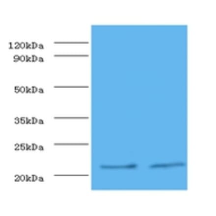 Metalloproteinase inhibitor 1 Polyclonal Antibody from Signalway Antibody (42350) - Antibodies.com