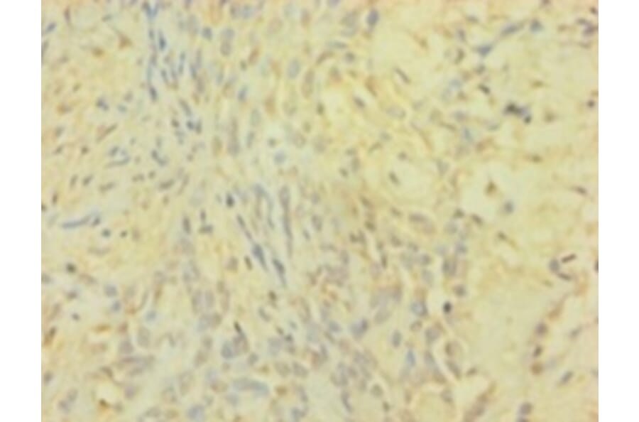 Immunohistochemistry - Metalloproteinase inhibitor 1 Polyclonal Antibody from Signalway Antibody - Antibodies.com